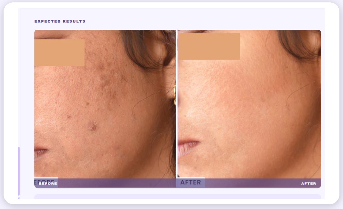 Aurelin product page — expected results before/after visual module